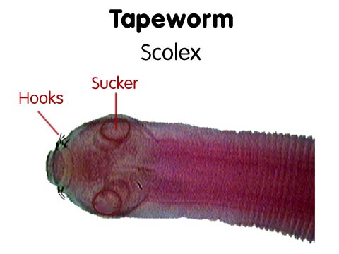Tapeworm_scolex-1.jpg